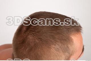 Hair texture of Gene 0003